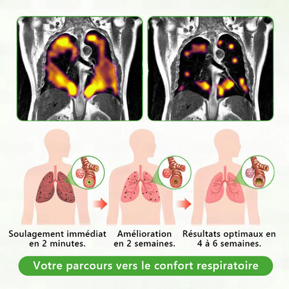 𝐃é𝐭𝐞𝐧𝐮𝐞 𝐞𝐭 𝐞𝐱𝐩𝐥𝐨𝐢𝐭é𝐞 𝐩𝐚𝐫 𝐥𝐚 𝐅𝐫𝐚𝐧𝐜𝐞✅ 𝑴𝒖𝒓𝙬𝙤𝐧® 𝑫𝒊𝒇𝒇𝒖𝒔𝒆𝒖𝒓 𝒅𝒆 𝑵𝒆𝒕𝒕𝒐𝒚𝒂𝒈𝒆 𝑷𝒖𝒍𝒎𝒐𝒏𝒂𝒊𝒓𝒆 à 𝒍𝒂 𝑴𝒐𝒍è𝒏𝒆 𝑩𝒐𝒕𝒂𝒏𝒊𝒒𝒖𝒆 (🫁 Toux, Pharyngite, essoufflement, expectorations, nez bouché, bronchite, symptômes allergiques, gêne pulmonaire)3🎁